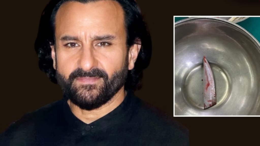 If the Knife Went 2 mm Deeper...   Saif Ali Khan Survives Horrific Attack